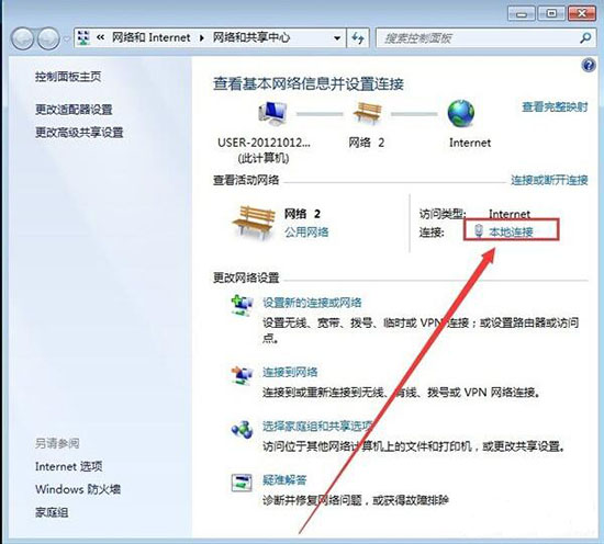本地连接